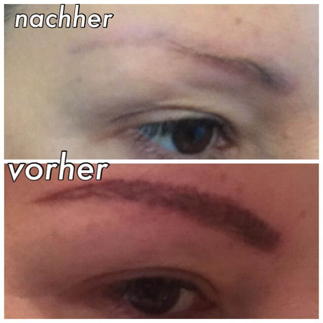 Permanent Make Up Entfernen In Wien Ohne Laser Hautschonend